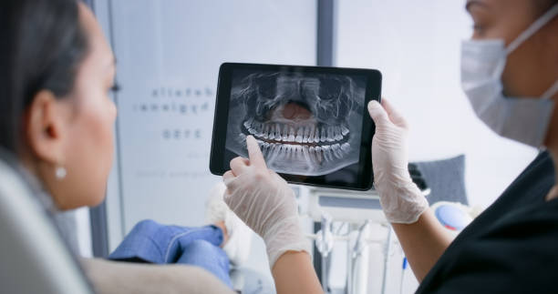 Licensed Wisdom Tooth Removal service in Salisbury, NC - Smile Center Dentistry